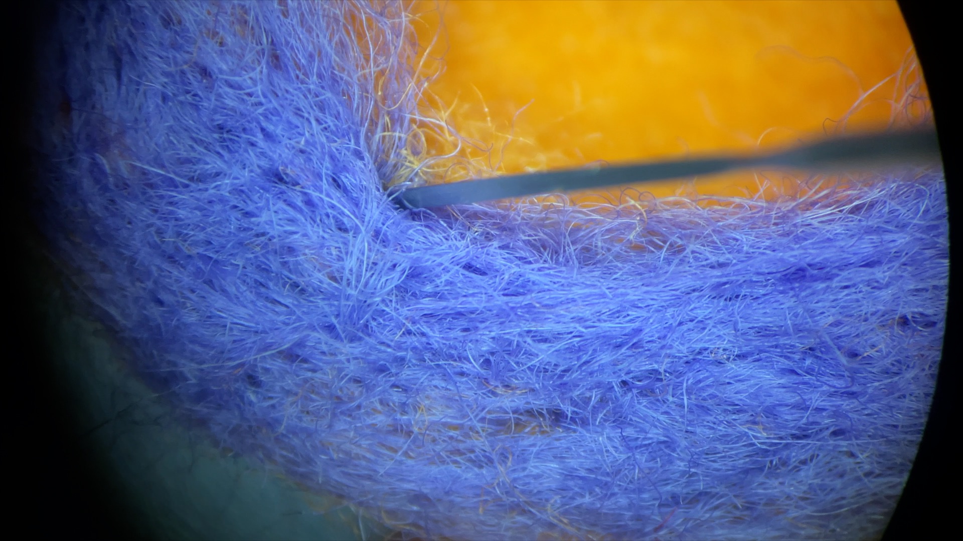 Needle felting under the microscope